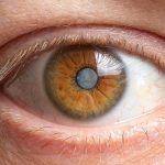 A Complete Guide to Cataracts